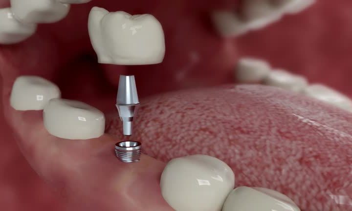 Kids Smiles Dentistry Denver Creating Bright Smiles for Children